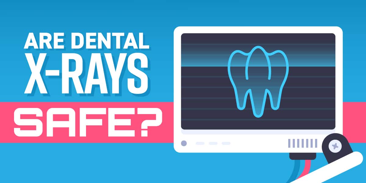 Are Dental X-Rays Safe?